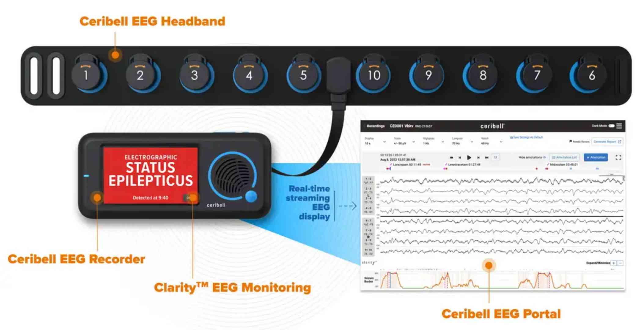 Ceribell AI EEG